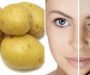 Using potato on skin gives amazing results; Here know how?